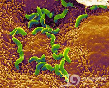 幽门螺旋杆菌的方式传播,生活当中如何预防幽门螺旋杆菌
