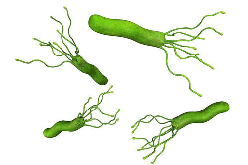 幽门螺旋杆菌感染的症状有哪些,幽门螺旋杆菌检查方法